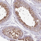 Immunohistochemical staining of human testis shows strong membranous positivity in spermatids and spermatocytes.