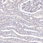 Immunohistochemical staining of human kidney shows no cytoplasmic positivity in cells in tubules and cells in glomeruli as expected.