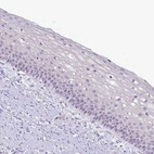 Immunohistochemical staining of human cervix, uterine shows no cytoplasmic positivity in squamous epithelial cells as expected.