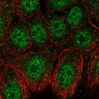 Immunofluorescent staining of human cell line MCF7 shows localization to nucleoplasm & cytosol.