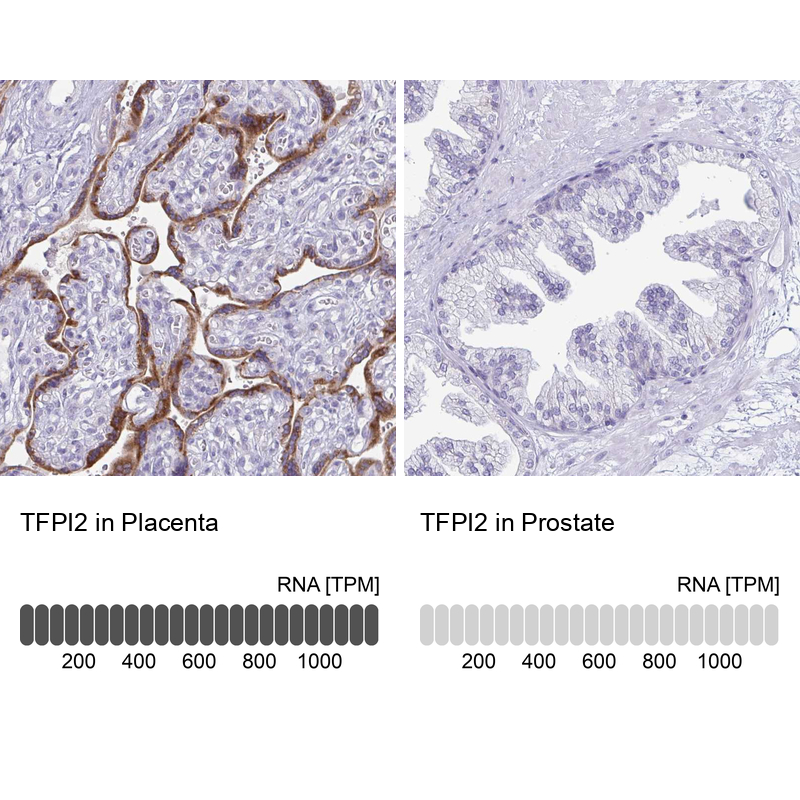 Anti-TFPI2 Antibody