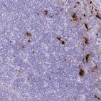 Anti-TPSB2 Antibody