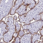 Immunohistochemical staining of human placenta shows strong cytoplasmic positivity in trophoblastic cells.