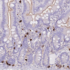 Immunohistochemical staining of human gastrointestinal shows strong cytoplasmic positivity in lymphoid cells.