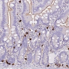 Immunohistochemical staining of human gastrointestinal shows strong cytoplasmic positivity in lymphoid cells.