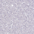 Immunohistochemical staining of human liver shows no positivity in hepatocytes as expected.