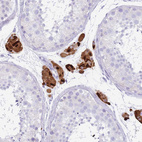 Immunohistochemical staining of human testis shows strong cytoplasmic positivity in Leydig cells.