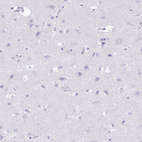 Immunohistochemical staining of human cerebral cortex shows no positivity in neurons as expected.