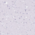 Immunohistochemical staining of human cerebral cortex shows no positivity in neurons as expected.