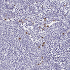 Immunohistochemical staining of human lymph node shows strong cytoplasmic positivity in a subset of non-germinal center cells.