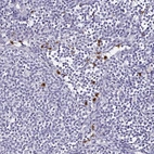 Immunohistochemical staining of human lymph node shows strong cytoplasmic positivity in a subset of non-germinal center cells.