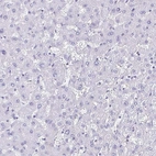 Immunohistochemical staining of human Liver shows no positivity in hepatocytes as expected.