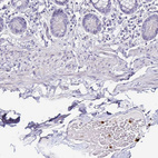 Immunohistochemical staining of human small intestine shows strong cytoplasmic positivity in leukocytes.