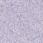 Immunohistochemical staining of human pancreas shows no positivity in exocrine glandular cells as expected.