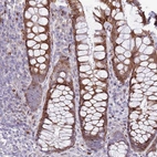 Anti-ANO8 Antibody