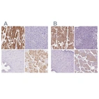 Immunohistochemical staining of human heart muscle, pancreas, prostate and skeletal muscle using Anti-MYOM1 antibody HPA049193 (A) shows similar protein distribution across tissues to independent antibody HPA014305 (B).