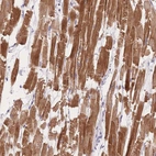 Immunohistochemical staining of human heart muscle shows strong cytoplasmic positivity in myocytes.