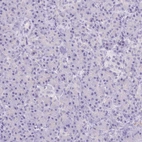 Immunohistochemical staining of human pancreas shows no positivity in exocrine glandular cells as expected.