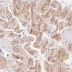 Immunohistochemical staining of human skeletal muscle shows cytoplasmic positivity in myocytes.