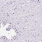 Immunohistochemical staining of human prostate shows no positivity in smooth muscle cells as expected.