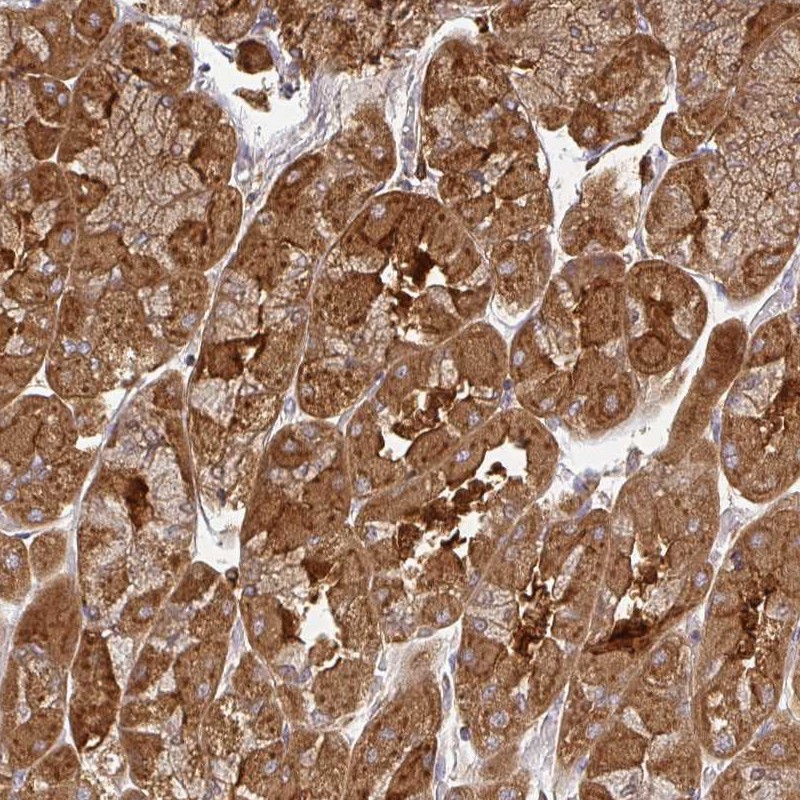 Anti-ZNF285 Antibody