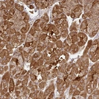 Anti-ZNF285 Antibody