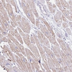 Anti-LCLAT1 Antibody