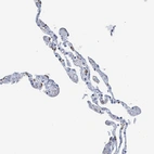Immunohistochemical staining of human lung shows weak granular cytoplasmic positivity in subset of pneumocytes.