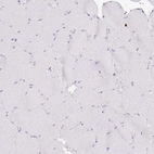 Immunohistochemical staining of human skeletal muscle shows no positivity in myocytes as expected.