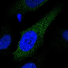 Anti-CYP2S1 Antibody