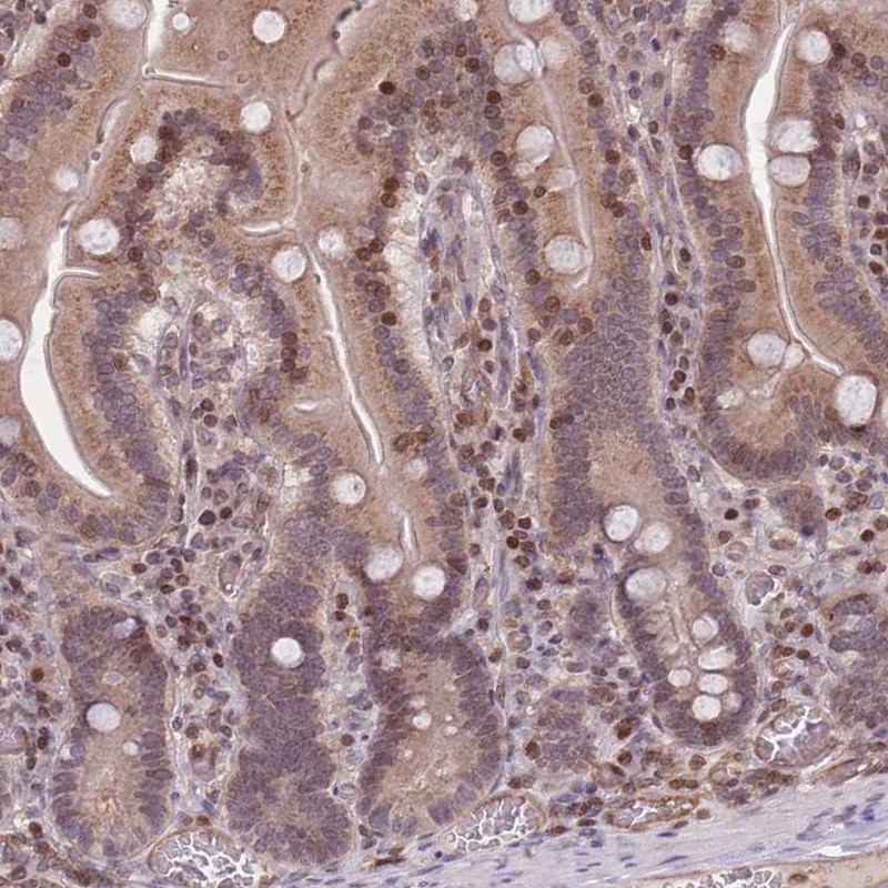 Anti-SLC35F5 Antibody