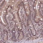 Anti-SLC35F5 Antibody
