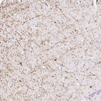 Immunohistochemical staining of human cerebral cortex shows positivity in oligodendrocytes.