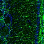 Immunofluorescence staining of mouse olfactory bulb shows immunoreactivity in processes in external plexiform layer.