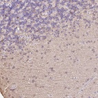 Immunohistochemical staining of human cerebellum shows moderate nuclear and cytoplasmic positivity in cells in granular layer.