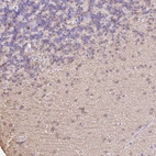 Immunohistochemical staining of human cerebellum shows moderate nuclear and cytoplasmic positivity in cells in granular layer.