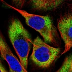 Immunofluorescent staining of human cell line U-2 OS shows localization to cytosol.