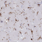 Anti-AIF1 Antibody