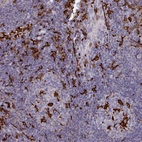 Immunohistochemical staining of human lymphoid tissues shows very strong membranous positivity in non-germinal, and germinal center cells.