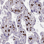 Anti-AIF1 Antibody