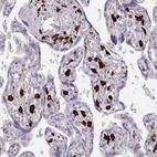 Immunohistochemical staining of human placenta shows very strong cytoplasmic positivity in Hofbauer cells.