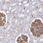 Immunohistochemical staining of human kidney shows strong membranous positivity in cells in glomeruli.
