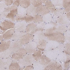 Immunohistochemical staining of human skeletal muscle shows very weak cytoplasmic positivity in myocytes.