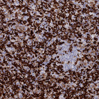 Anti-AIF1 Antibody