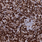 Immunohistochemical staining of human spleen shows very strong membranous positivity in cells in red pulp.