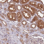 Anti-EIF3F Antibody