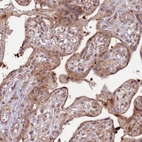 Anti-PRR16 Antibody