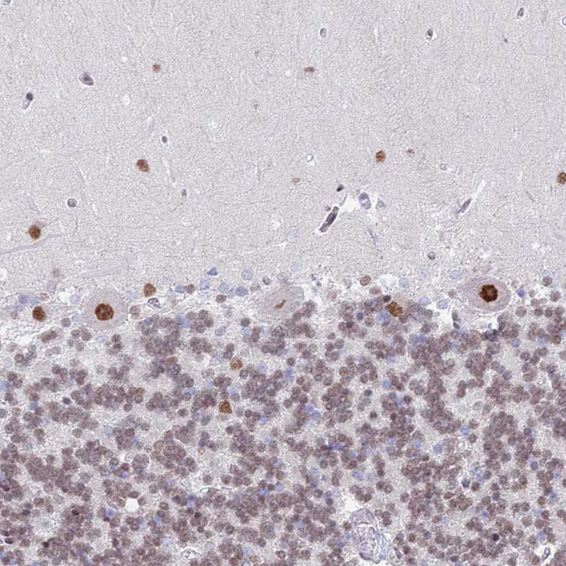 Anti-ZNF382 Antibody