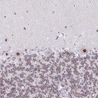 Anti-ZNF382 Antibody