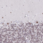 Anti-ZNF382 Antibody